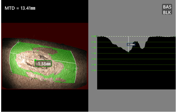 韋林視頻內(nèi)窺鏡深度剖面測量示意圖 韋林視頻內(nèi)窺鏡深度剖面測量示意圖